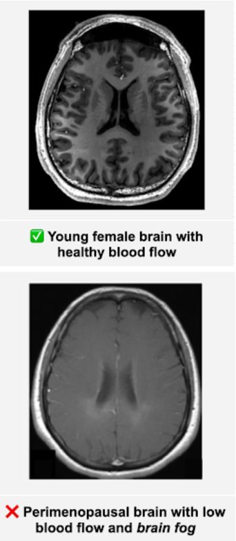Meno Brain Support